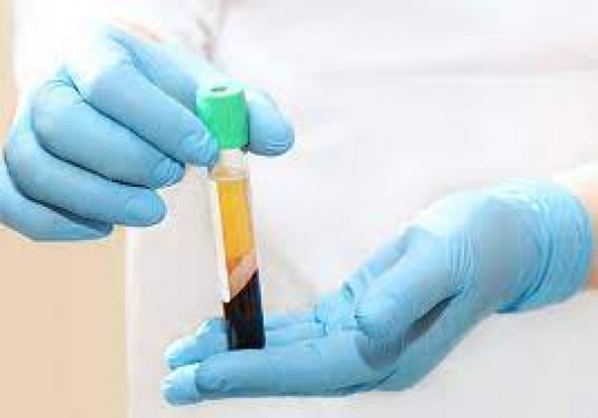 PLASMA / FIBRIN | VAMPIRE LIFTING