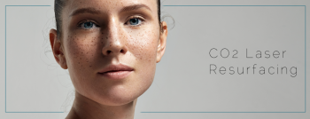 CO2 Fractional Laser